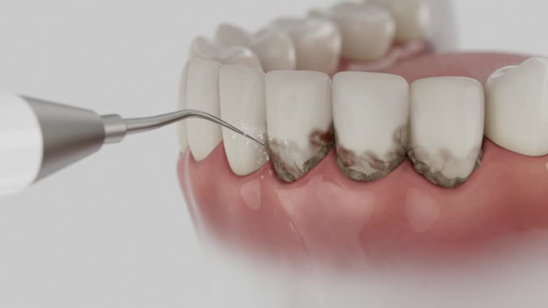 Reliable Dental contractor in Cleves, OH by Smile Center Dentistry
